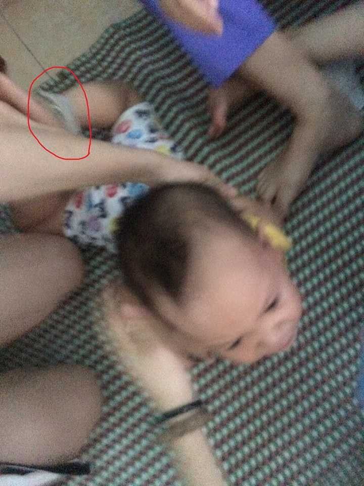 Chân tay của bé Long đều bị trói chặt 