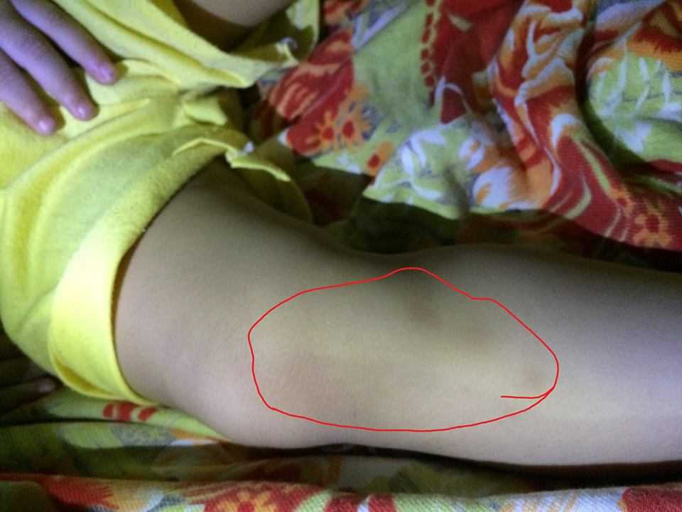 Phẫn nộ vụ 3 cô giáo trói chân tay, nhét giẻ vào mồm bé mầm non