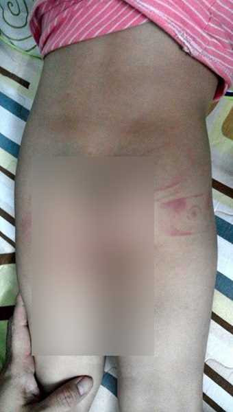 Bạo hành trẻ em