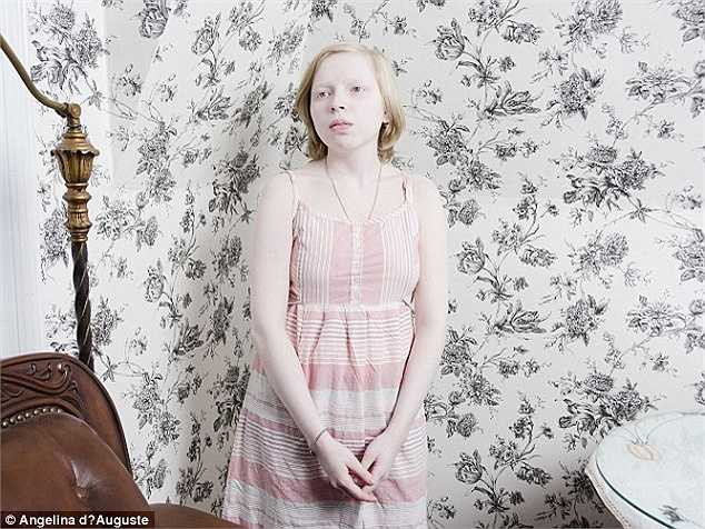 Ngoài ra, những người bạch tạng luôn là đối tượng bị chọc ghẹo khi họ bước chân ra ngoài xã hội. 