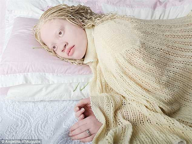 Những nhân vật trong ảnh được chụp với bộ quần áo màu pastel trên một phông nền trắng nhạt nhằm khắc họa rõ nét cuộc sống bế tắc của những người đang mang trong mình căn bệnh bạch tạng.