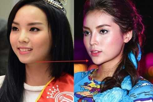 Khuôn mặt của Kỳ Duyên hiện tại khiến nhiều người nghi ngờ