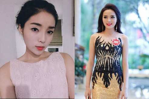 Khuôn mặt của Kỳ Duyên hiện tại khiến nhiều người nghi ngờ