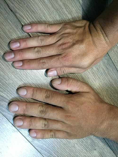 Chàng trai tuấn tú bỗng chốc biến thành 'ông lão'