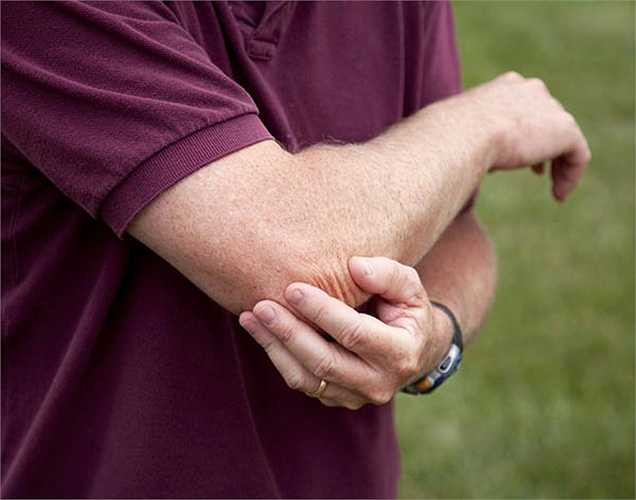 Tốt cho bệnh thấp khớp: Thuộc tính chống viêm của hạt đu đủ tốt cho điều trị viêm khớp và các bệnh khớp. Tuấn Phong (theo Boldsky).