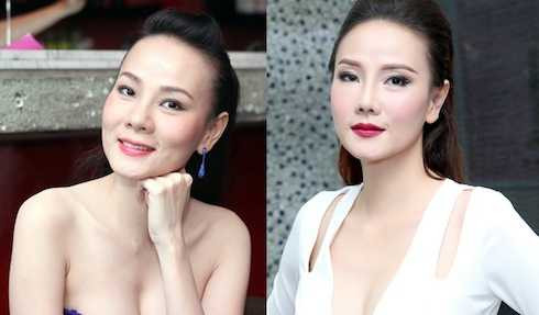 Ngoài ra cô còn bị lõm một vài điểm trên gương mặt hay bị bọng mắt và bàn tay hơi bị xương.