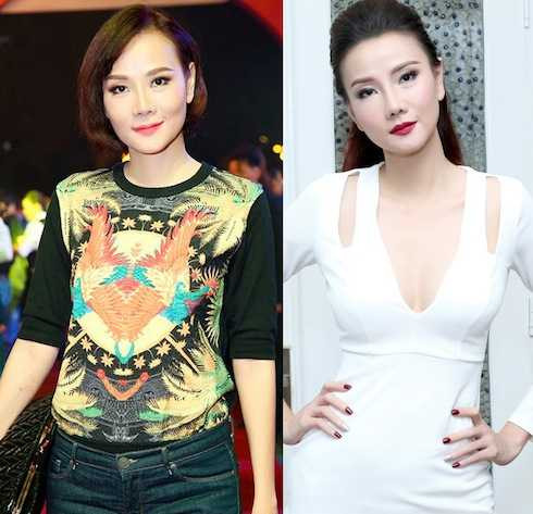 Cô quyết định sửa mũi S-line, cấy mỡ lên mặt, lấy bọng mắt và ghép mỡ mu bàn tay.