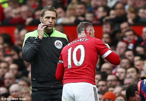 Rooney chảy máu đầu