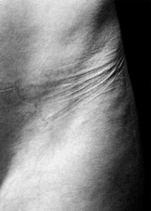 Bộ ảnh khiến bạn ngừng ngay thói quen mặc quần áo quá chật