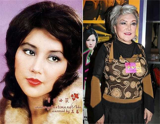 Thiệu Âm Âm: Ngôi sao Hong Kong ân hận vì từng thẩm mỹ và càng tiếc nuối khi nhìn lại ảnh quá khứ. Bà cho biết, khi gia nhập showbiz, vì muốn sớm thành công nên đã dao kéo.'Đó cũng là cách thức nhanh nhất để bạn trở nên rạng rỡ' - cô nói. Thiệu Âm Âm đã sửa mắt, mũi, bơm môi, độn cằm. Việc đeo đuổi công nghệ thẩm mỹ khiến khuôn mặt bà bị ảnh hưởng nhiều, đến mức gần như biến dạng. 'Cằm xô xệch, môi sưng phồng, càng có tuổi, tôi càng không nhận ra mình. Tôi phát hiện tác hại của thẩm mỹ khi mọi c