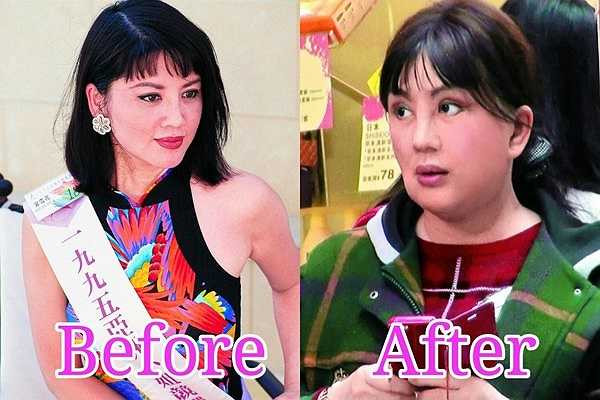 Cung Tuyết Hoa với gương mặt phù nề, biến dạng sau thẩm mỹ. Nữ diễn viên gạo cội từng lọt vào vòng chung kết Hoa hậu Hong Kong cho rằng cuộc đời bà sai lầm lớn nhất là sửa mặt.