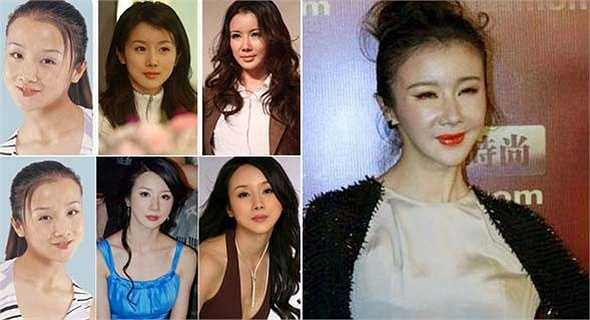 Tôn Phi Phi khi mới gia nhập làng giải trí có vẻ đẹp tự nhiên, không hoàn hảo nhưng cũng thuộc hàng tú nữ. Nhưng hình ảnh gần đây cho thấy, mặt cô sưng phù, môi biến dạng. Nhiều trang mạng cho rằng Tôn Phi Phi sai lầm khi đã dao kéo.