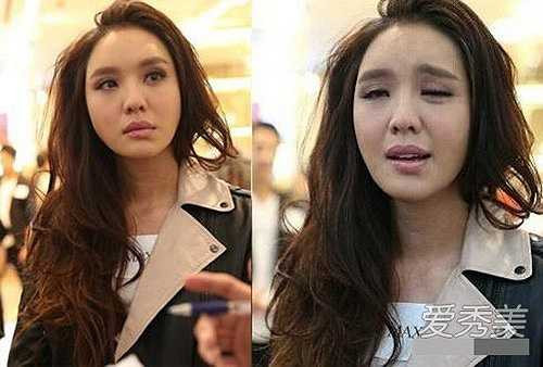 Quan Ân Na từng né tránh câu hỏi về chuyện dao kéo. Nhưng gương mặt bị méo của cô là bằng chứng cho thấy cô sai lầm khi bơm botox và chỉnh môi. 