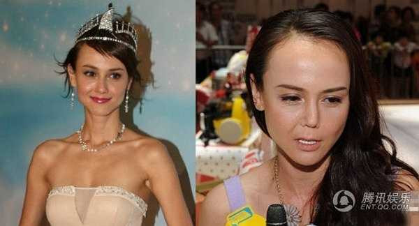 Hàn Quân Đình từng là Hoa hậu châu Á xinh đẹp của thập niên 90. Nhưng gần đây khi xuất hiện trở lại, cô khiến nhiều người thất vọng với gương mặt khác lạ. Đặc biệt, vùng mũi mất cân đối, mặt biểu cảm cứng đờ. Cô thừa nhận đã phải phẫu thuật thẩm mỹ sau một tai nạn.