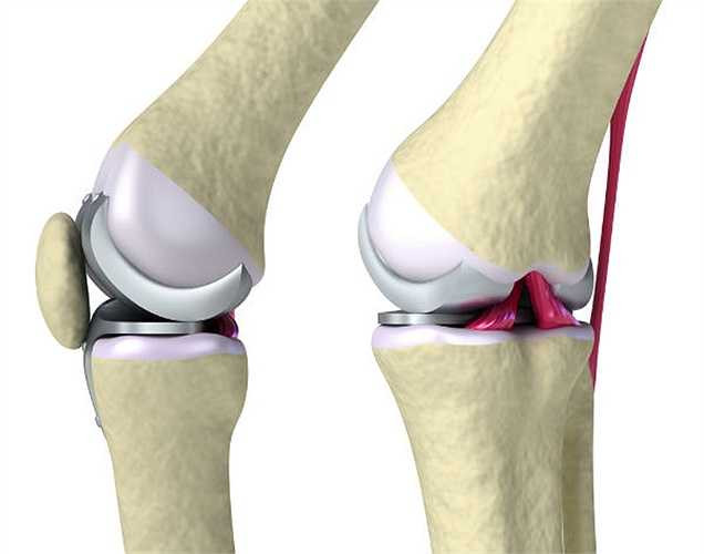 Sức khỏe xương: Một số lượng các vitamin, khoáng chất và phốt pho tốt cho sức khỏe của xương. Photpho không chỉ củng cố xương và răng mà còn ngăn chặn các nguy cơ như loãng xương.