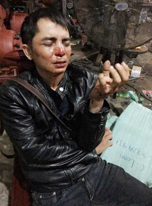 Anh Trần Hoài Nam kể lại vụ việc