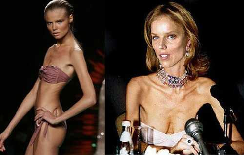 Nhiều người mẫu tự ép mình về size 0 để có được show diễn và hợp đồng quảng cáo