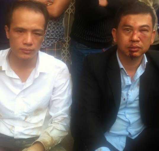 Luật sư Luân và Thu Nam bị hành hung, cướp tài sản sau khi làm việc tại địa bàn huyện Chương Mỹ, TP Hà Nội (ảnh FB nạn nhân).