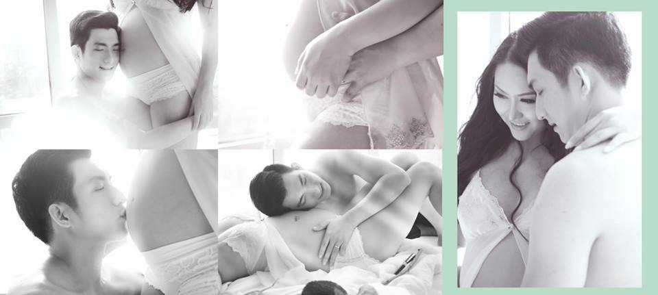 "Nữ hoàng dao kéo" cho biết, thời gian cô nằm trên bàn mổ mất 150 phút để bác sĩ tạo hình mũi.