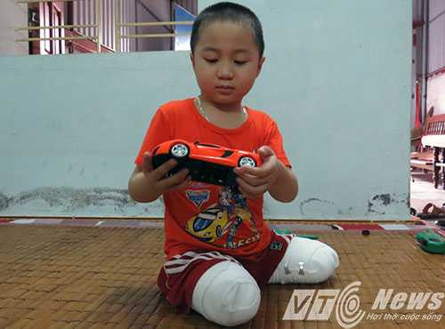 Bé Vũ bị cắt hai chân do vụ TNGT - Ảnh MK