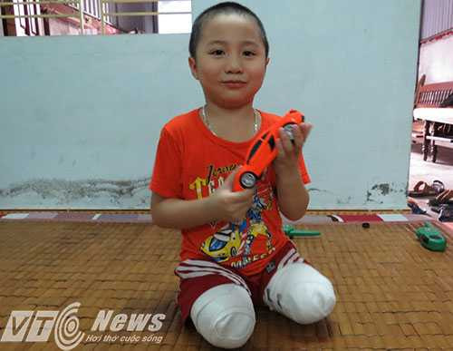 Để người mẹ được vui, bé Vũ cố gượng cười trong đau đớn - Ảnh MK