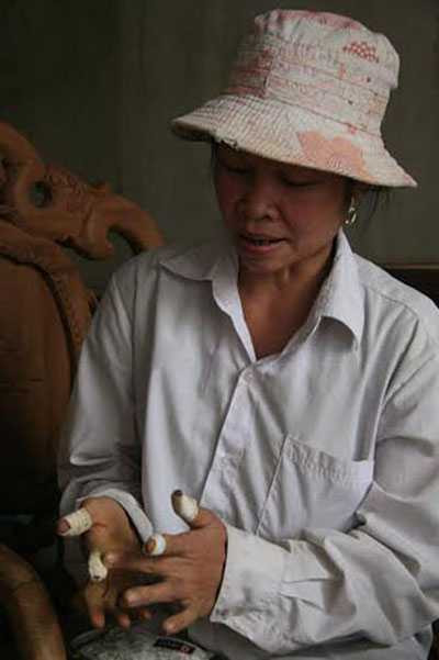 Chị Quyên phải băng kín các đầu ngón tay để lúc cà gỗ tay không bị mòn. Ảnh: C.T.L Chị Quyên phải băng kín các đầu ngón tay để lúc cà gỗ tay không bị mòn. Ảnh: C.T.L