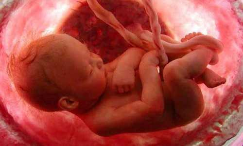 Ảnh minh họa: Thai chết lưu do tràng hoa cuốn cổ