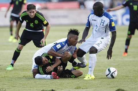 Cầu thủ Honduras gãy chân kinh hoàng, đứt 4 dây chằng