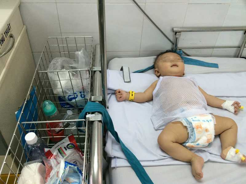 Bé Phát khi nằm điều trị viêm màng não tại Khoa Nhiễm. Ảnh: Thanh Huyền.