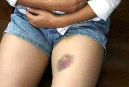 Thiếu nữ bị tố chém người như xã hội đen: 'Bị đánh nên rút dao tự vệ'