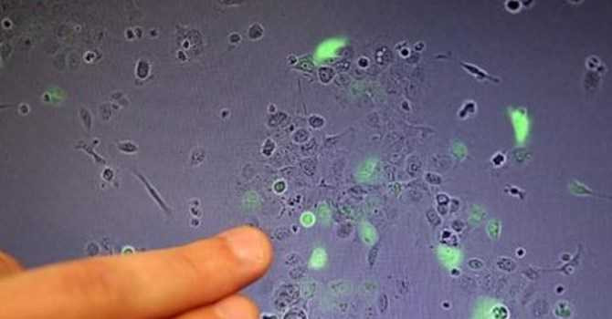 Phát hiện gen 'siêu vi khuẩn' nguy hiểm có trong thịt Trung Quốc