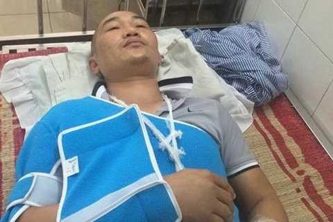 Anh Nguyễn Duy Kiện bị đánh gãy xương mu bàn tay trái, gãy mỏm vai phải, gãy 3 xương sườn trái, dập phổi gây tràn dịch màng phổi, tổn thương vùng đầu....đang được điều trị tại bệnh viện - Ảnh Văn Bình