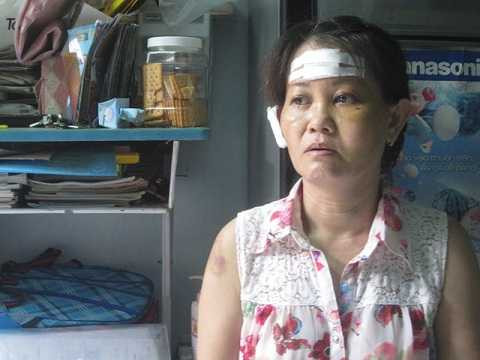 bà Nguyễn Anh Thảo 