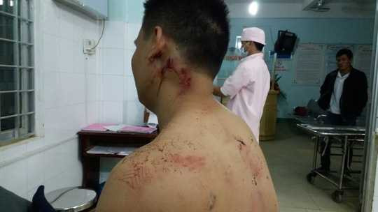 Một người bị thương trong vụ xô xát được điều trị tại bệnh viện