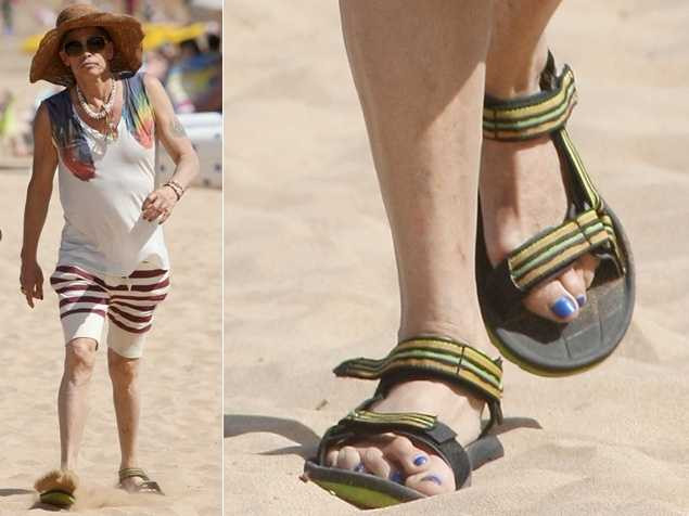 Loại bỏ u biến dạng ở khớp ngón chân cái