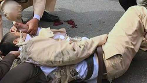 Cán bộ CSGT sau cú kéo lê 20 mét. Cán bộ CSGT sau cú kéo lê 20 mét.