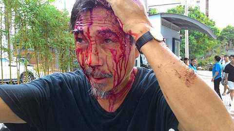 Vụ đụng độ đẫm máu, chung cư 4S Riverside, Công an, lệnh bắt khẩn cấp, hành hung, côn đồ