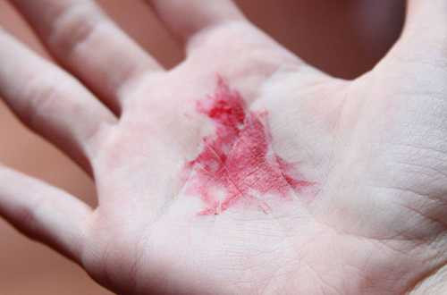 Đọc xong bài viết này, bạn sẽ không còn vứt vỏ trứng vào sọt rác