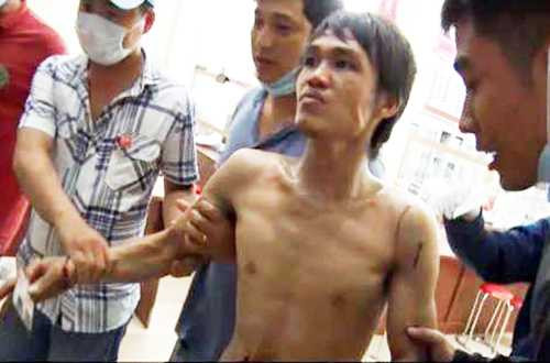 Kẻ ngáo đá đập phá ngân hàng tiếp tục 'quậy' bác sỹ trong bệnh viện
