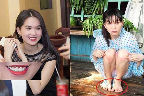 Nữ hoàng nội y Ngọc Trinh thu hút người đối diện với gương mặt ngây thơ và thân hình với số đo ba vòng hoàn hảo. Nhưng nhược điểm cười hở lợi nhiều khi khiến cho người đẹp trở nên kém sang. Gần đây, khi đóng phim Vòng eo 56, Ngọc Trinh lại bị soi bởi đôi bàn chân bè, các ngón chân xòe sang hai bên không đẹp mắt.