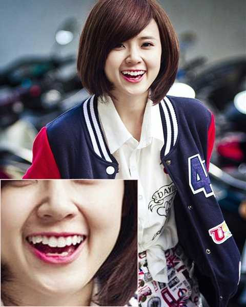 Nét không hoàn hảo trên gương mặt Midu chính là nếp nhăn ở phần má, dọc theo khuôn miệng khá rõ, đặc biệt là khi người đẹp nở nụ cười. Điều này làm cô nàng vô tình bị dừ đi so với lứa tuổi.