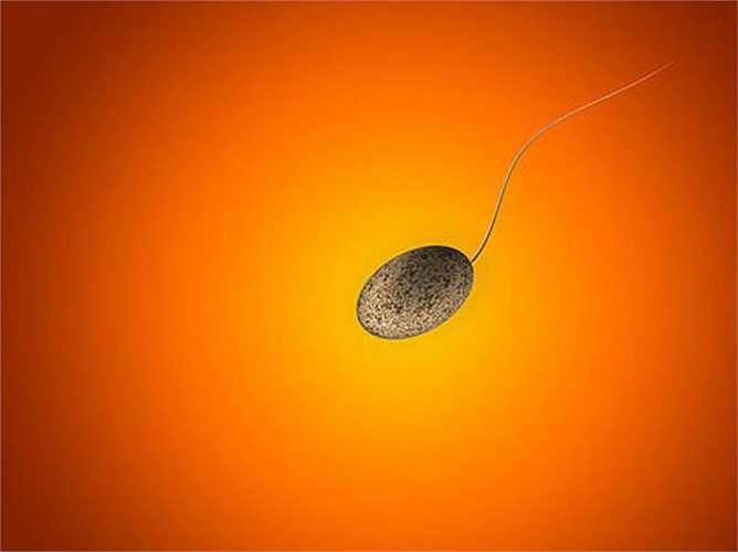 Tinh trùng bị biến dạng: Tinh trùng có vô số các khiếm khuyết ở đầu, cổ, hoặc đuôi. Tinh trùng bị biến dạng có thể có hai đầu, hai đuôi hoặc đuôi cuộn. Những bất thường có thể ảnh hưởng đến khả năng thụ tinh của tinh trùng với trứng, nhưng nó không có nghĩa là người đàn ông bị vô sinh. Đây là một trong những vấn đề về tinh trùng, mà người đàn ông nên biết. 