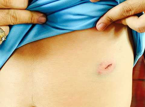 Con trai ông Út bị thương ở bụng, được cho là do đạn cao su của nhóm người đột nhập gây ra. Làm việc với cảnh sát, Bí thư Út cho hay không mất tài sản và nhận định nhóm đột nhập có thể là trộm.