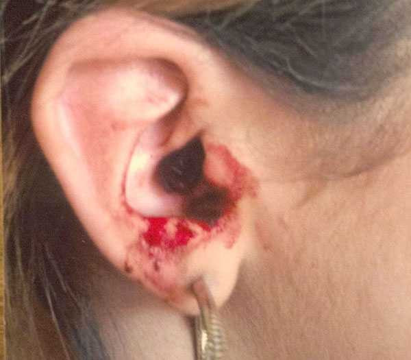 Căn bệnh kỳ lạ của Marnie Harvie là thách thức với giới y khoa Căn bệnh kỳ lạ của Marnie Harvie là thách thức với giới y khoa