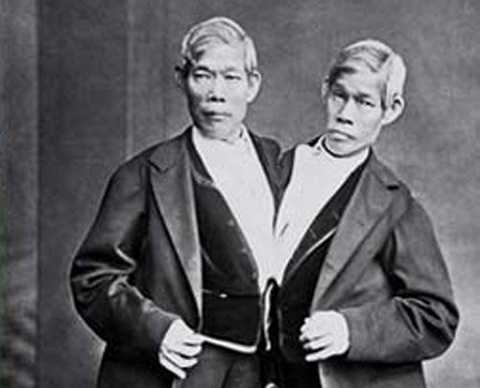 Cặp song sinh Chang và Eng Bunker