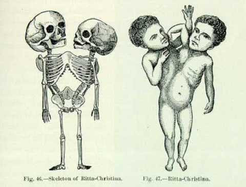 Ritta and Christina Parodi