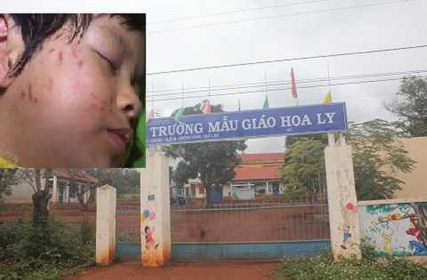 Ngôi trường bé Vy đã từng học.Ảnh:Thanh Hải Ngôi trường bé Vy đã từng học.Ảnh:Thanh Hải