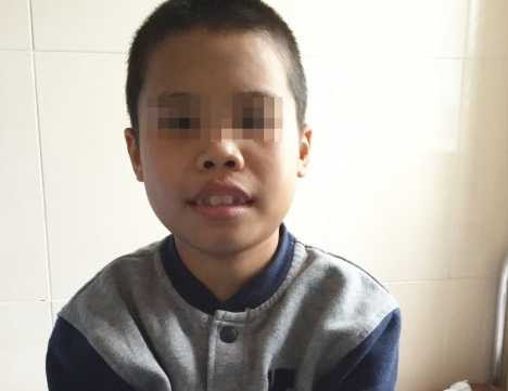 Bé Minh sau ghép thận.