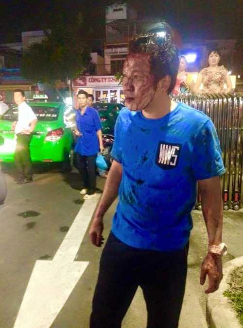 Nam thanh niên bị bảo vệ 'đánh hội đồng' vì chen hàng gửi xe