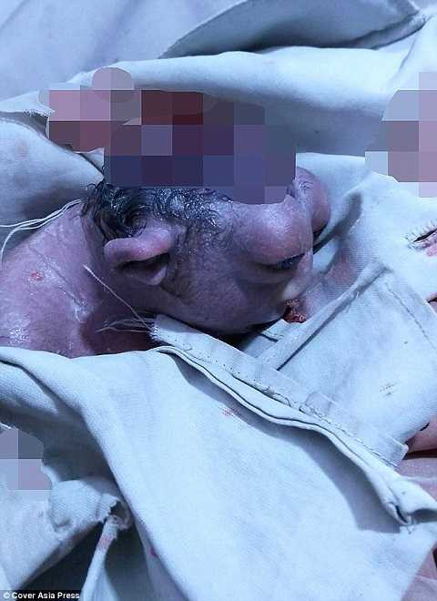 Biến chứng là do thói quen ăn uống của người mẹ Biến chứng là do thói quen ăn uống của người mẹ